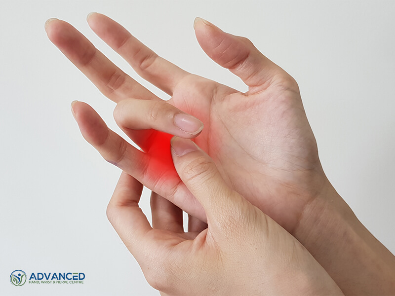 Image of trigger finger pain