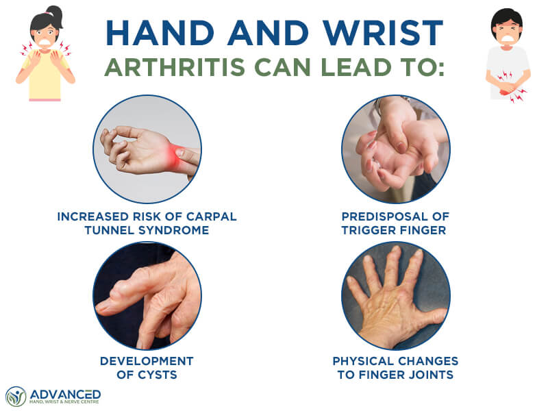 Infographics showing effects of hand and wrist arthritis