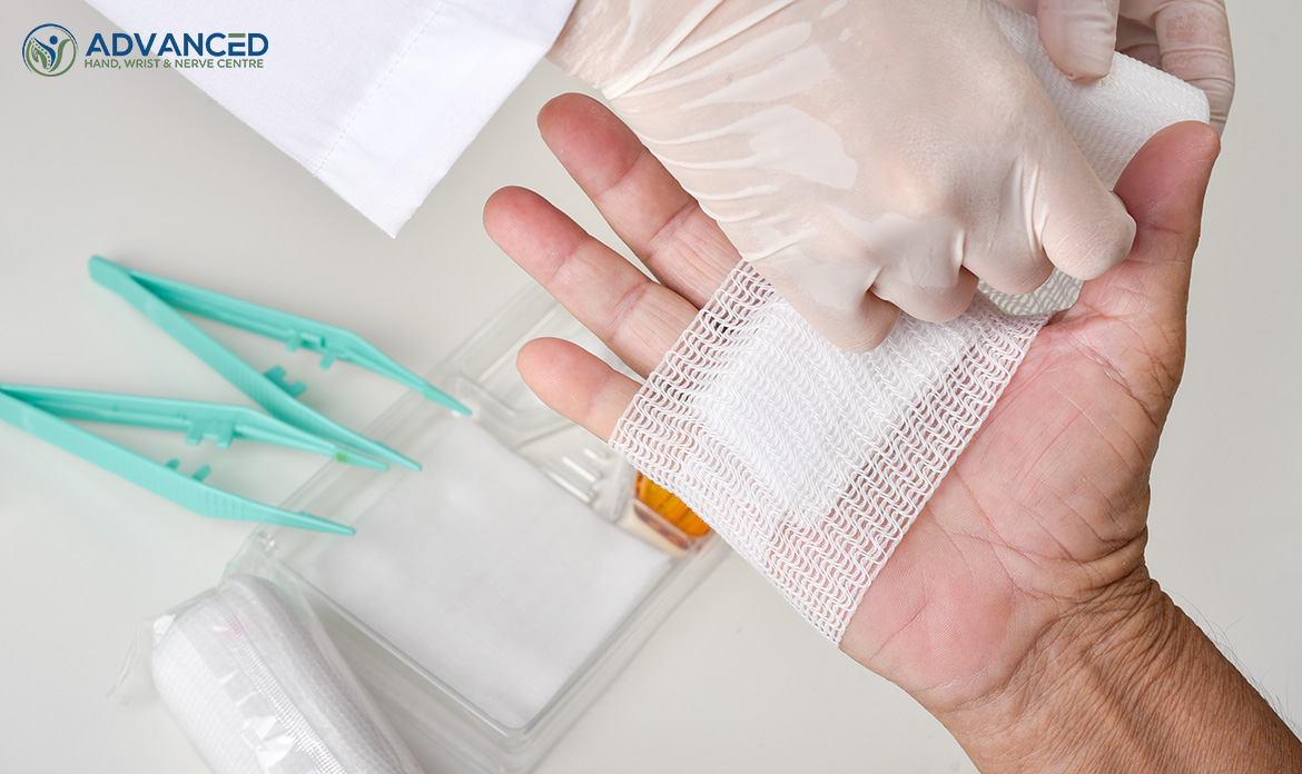 Image Enhancing Hand Surgery Recovery Strategies 
