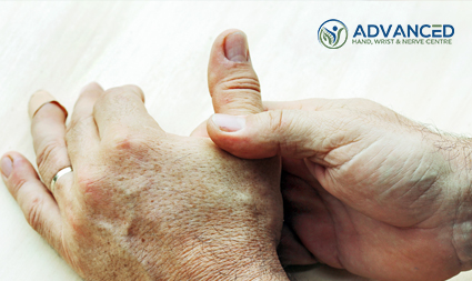 Guide to Basal Thumb Arthritis Causes and Symptoms
