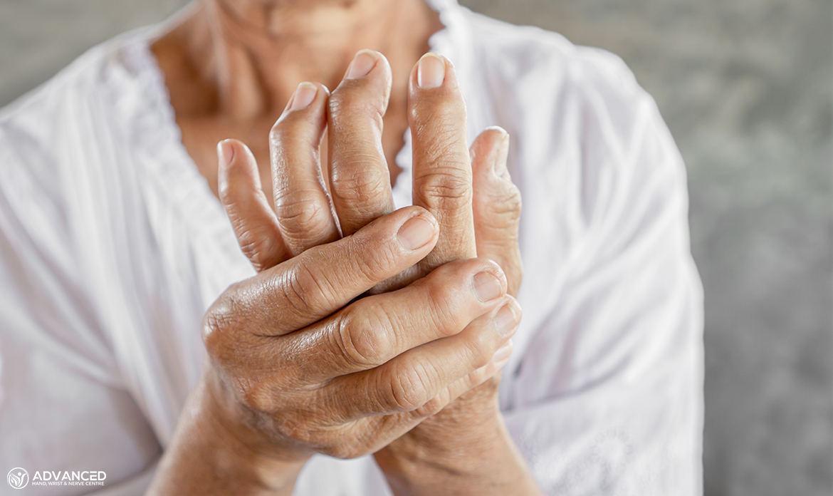 Image Hand Arthritis Pains