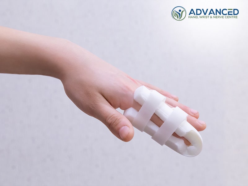 Image of Finger Injury