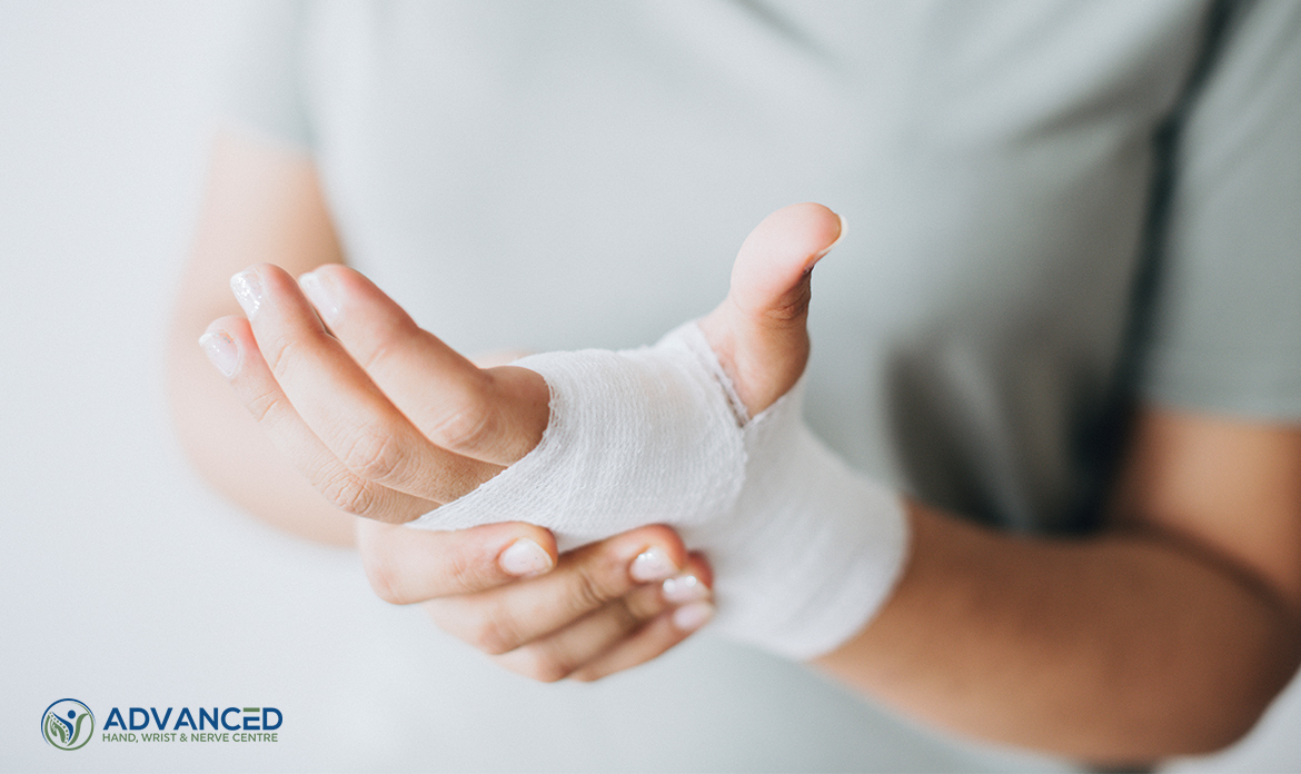 Things To Expect After A Hand Surgery In Singapore