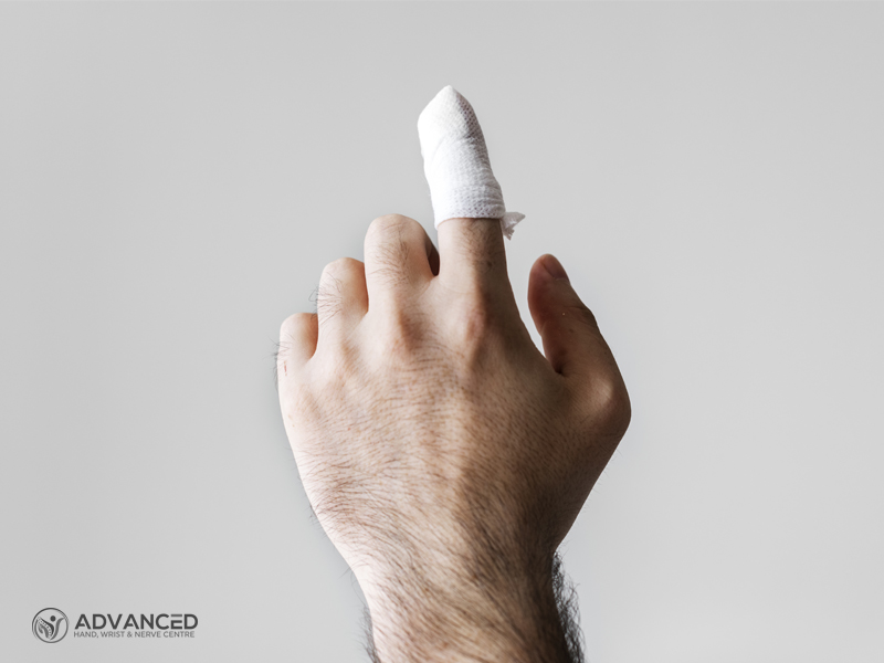 Jammed finger - hand specialist in Singapore