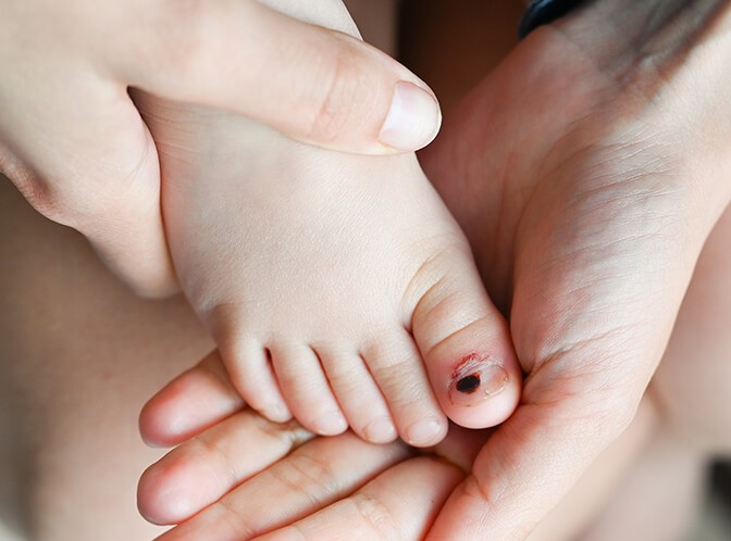 Nailbed & Fingertip Injuries Singapore