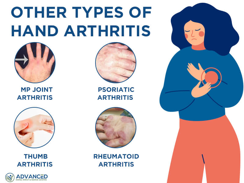Infographics Showing Other Types of Hand Arthritis