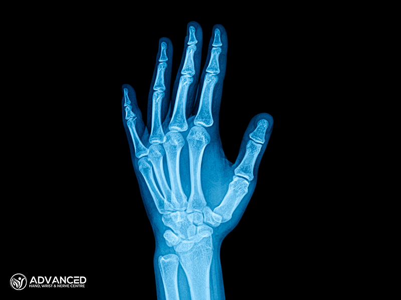 Palm X-ray Film