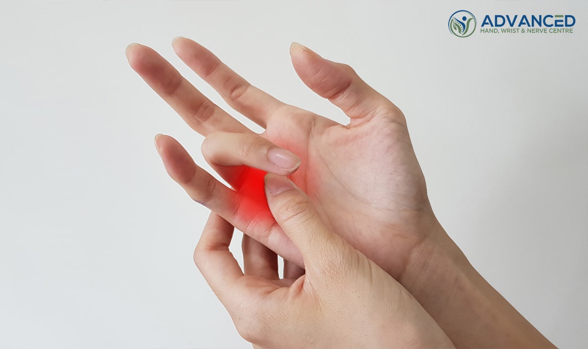 Tips to Prevent Recurrence of Trigger Finger Singapore