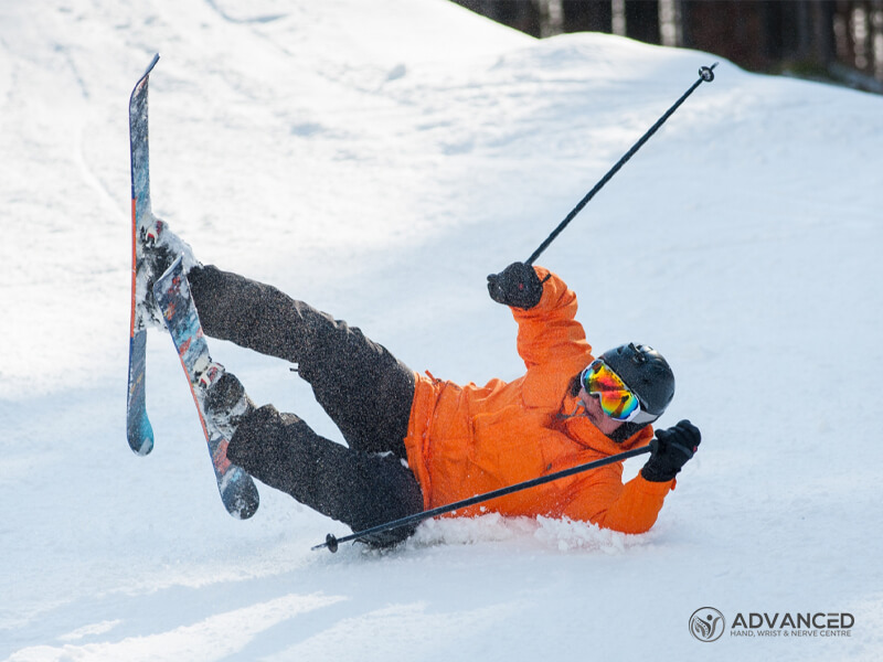 Skiers thumb - hand specialist in Singapore