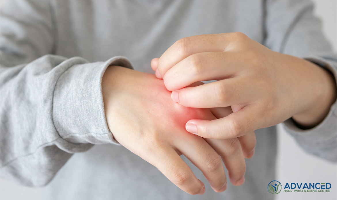 Image Swollen area on hand caused by hand infection