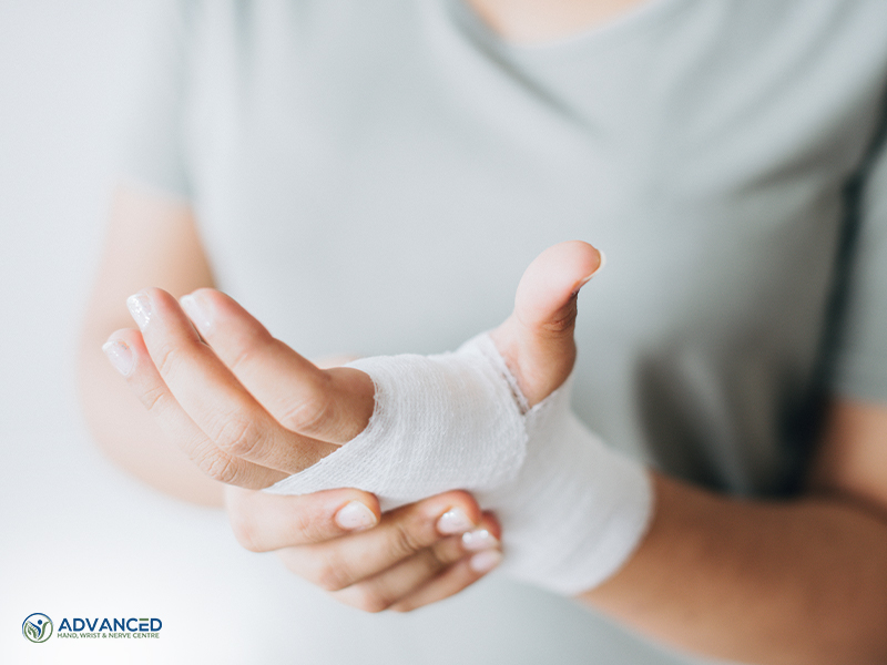 TFCC injury hand and wrist specialist