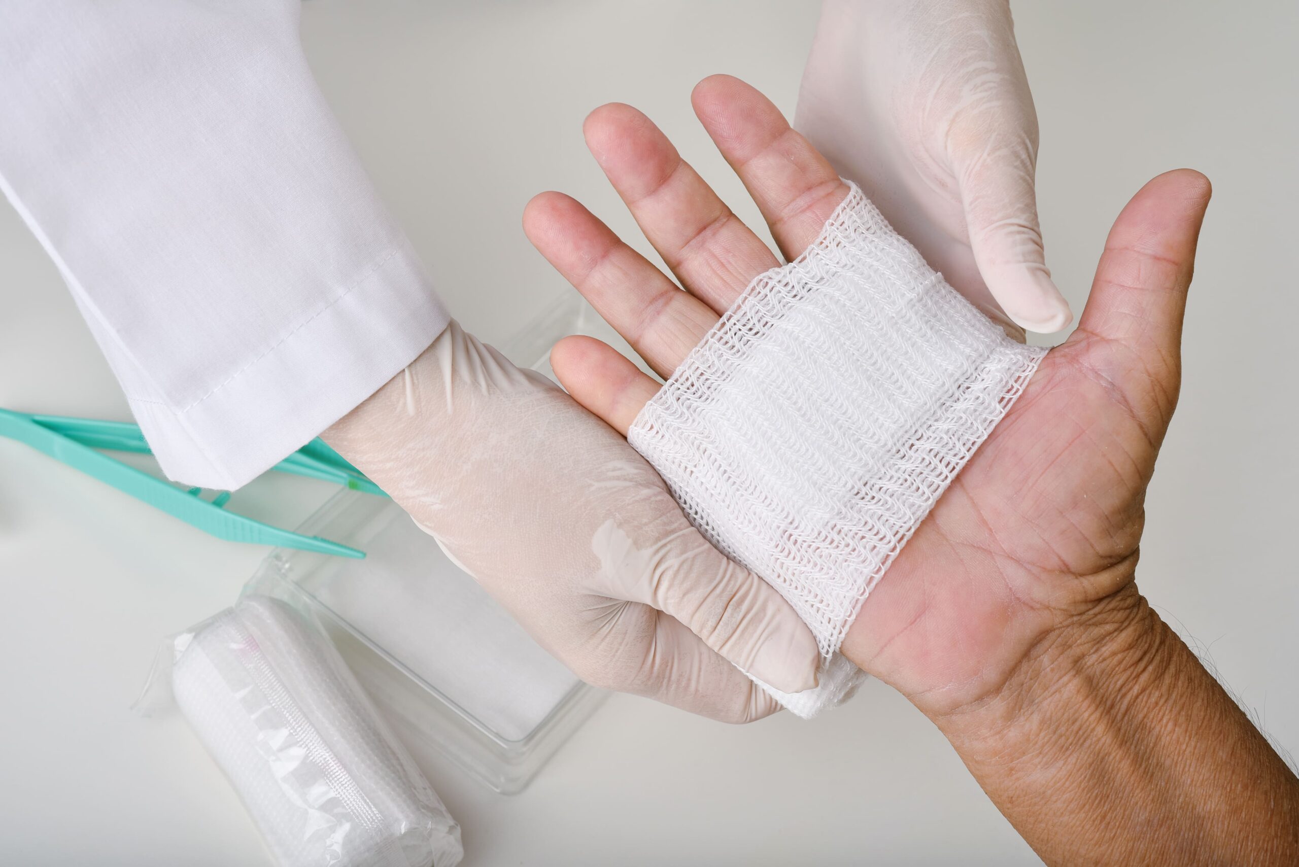 Surgery for Hand Infections Singapore