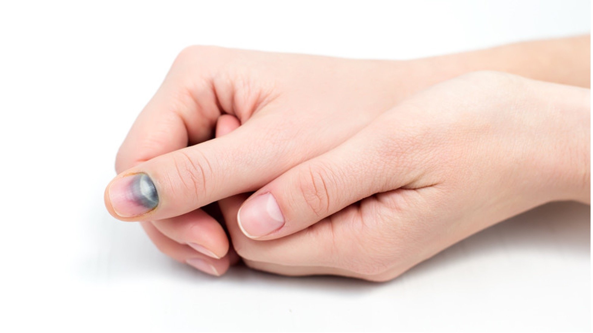 Nailbed & Fingertip Injuries Singapore