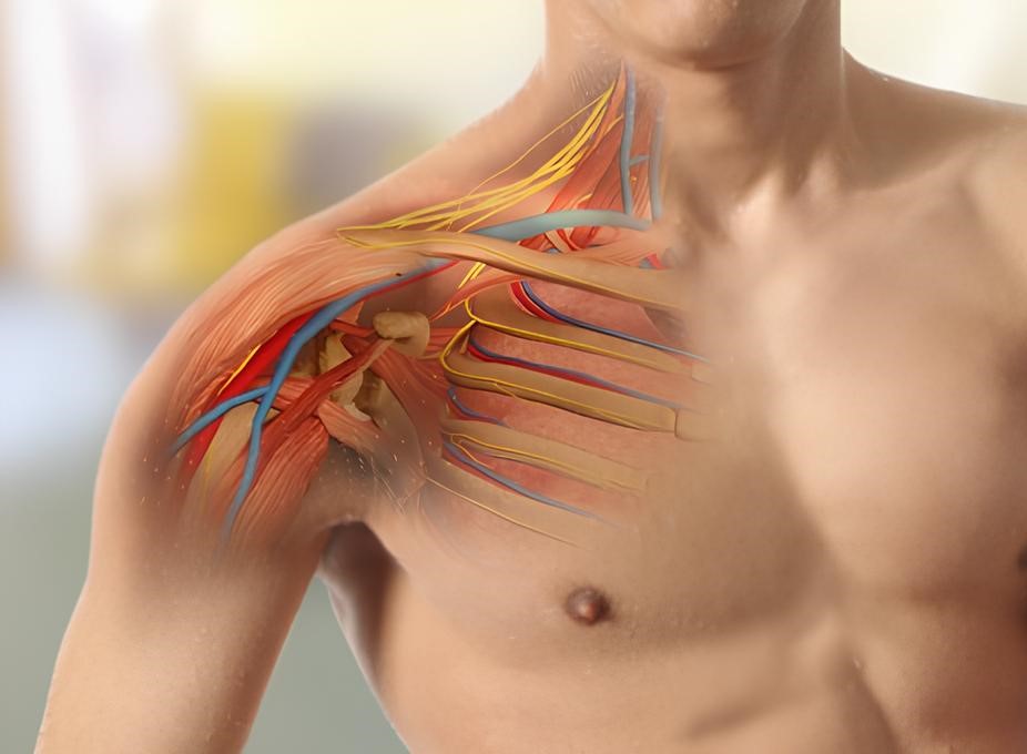 Brachial Plexus Surgery in Singapore