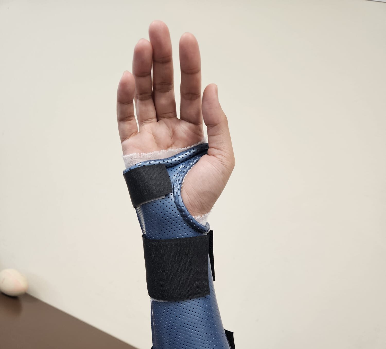 Wrist Ligament Injuries Singapore