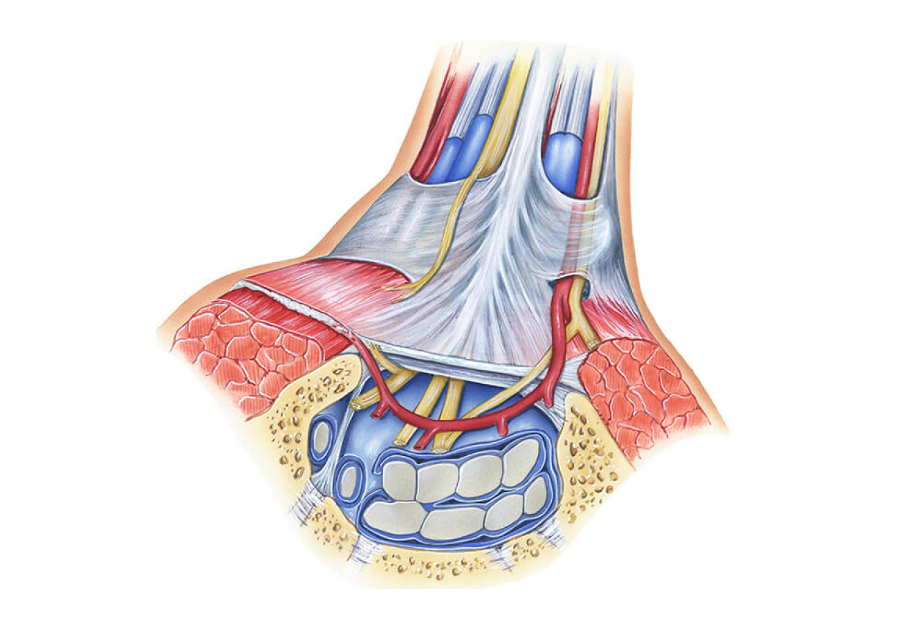 Illustration Of Carpal Tunnel Syndrome Treatment In Singapore