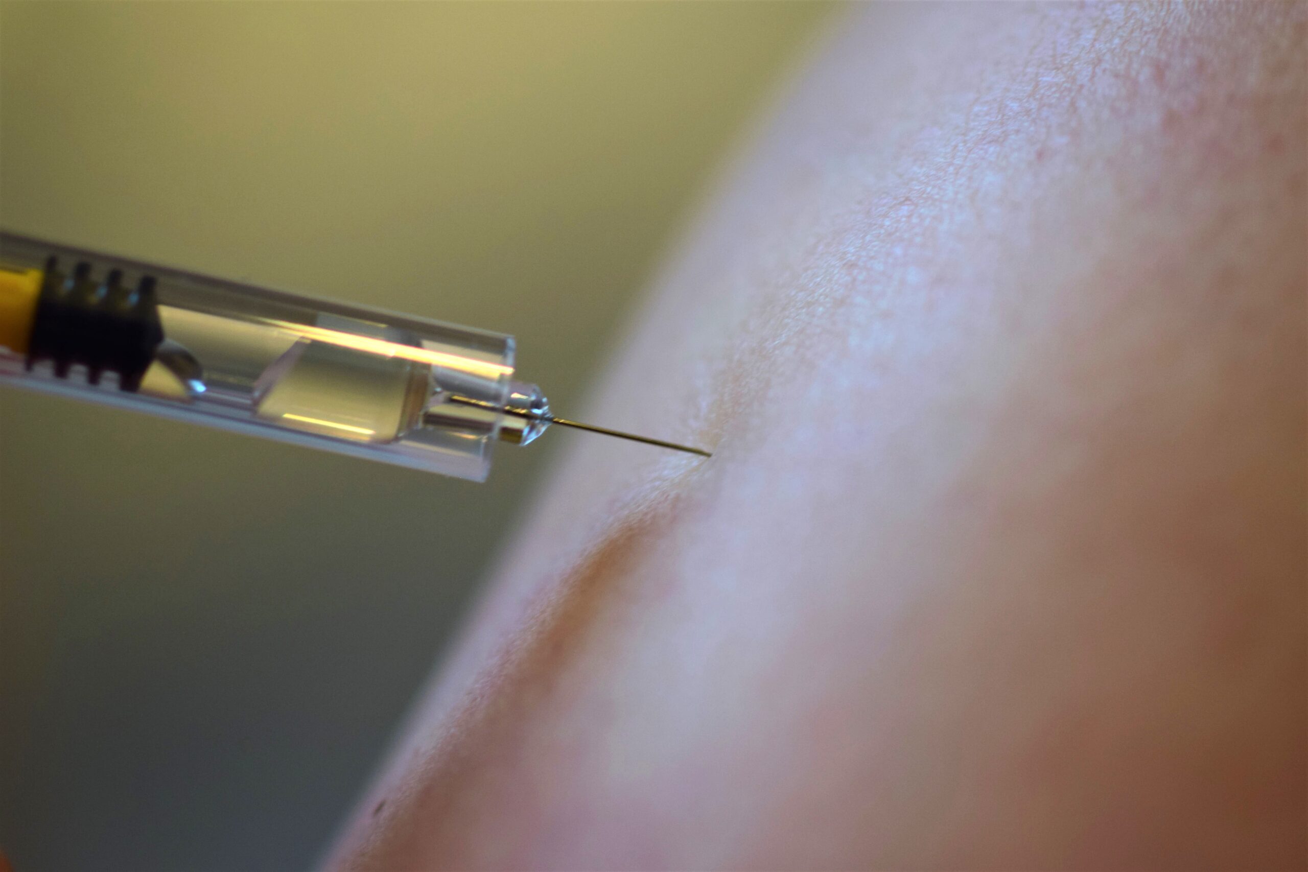 Platelet-Rich Plasma (PRP) Injection Singapore