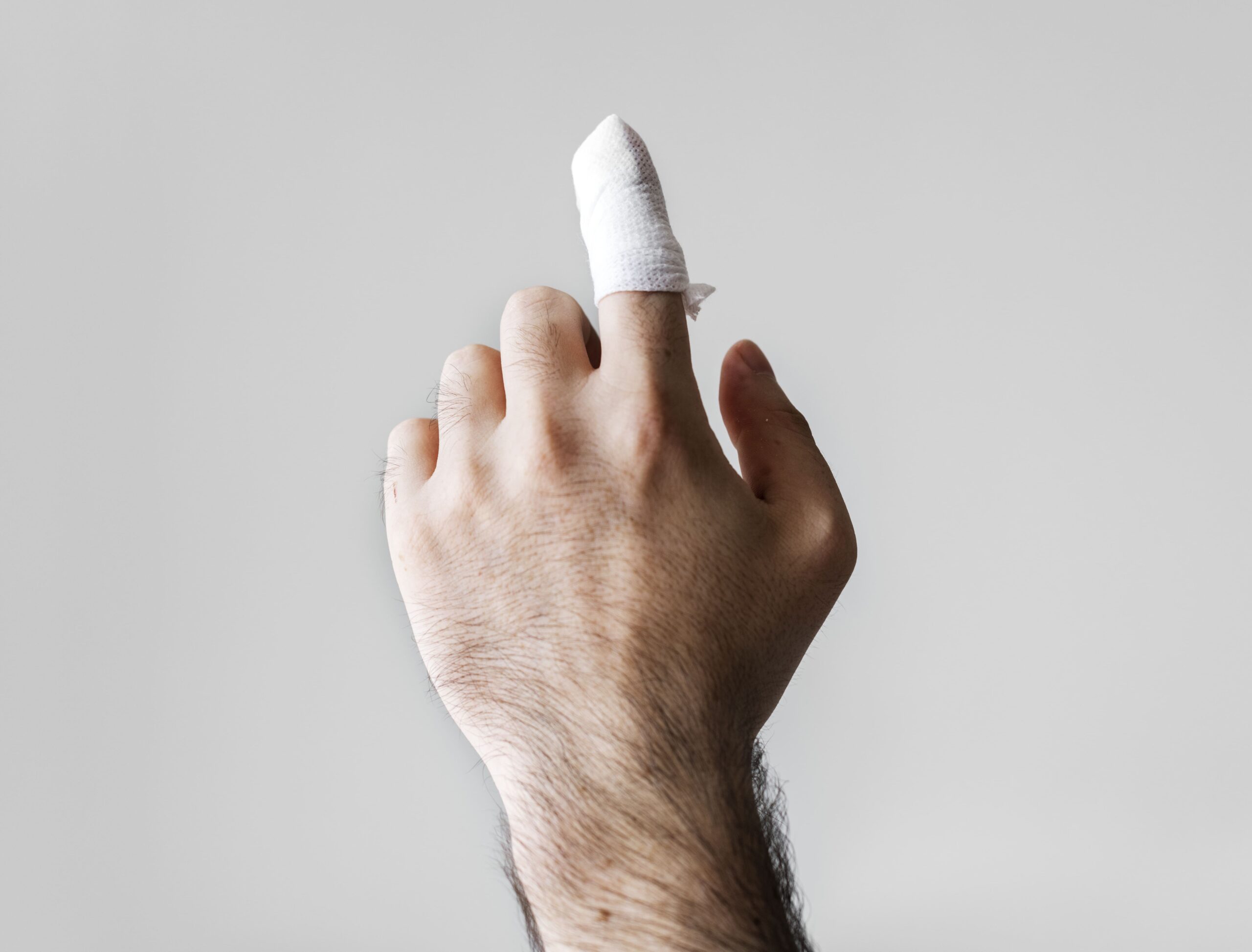 Trauma (Finger Lacerations, Animal Bites) Singapore