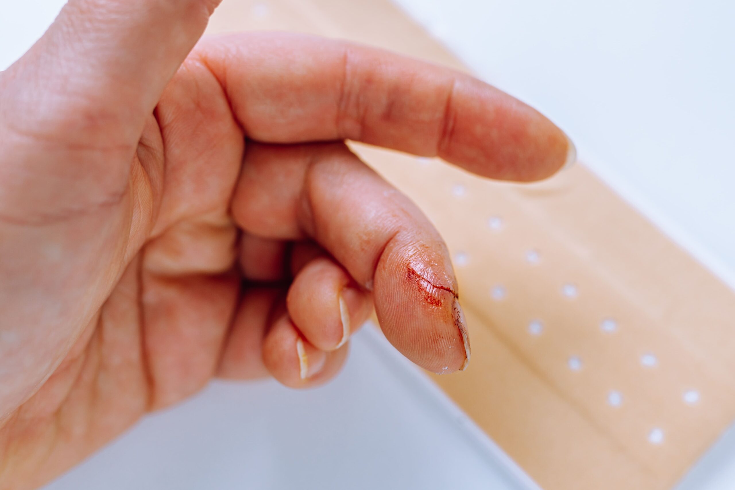 Trauma (Finger Lacerations, Animal Bites) Singapore