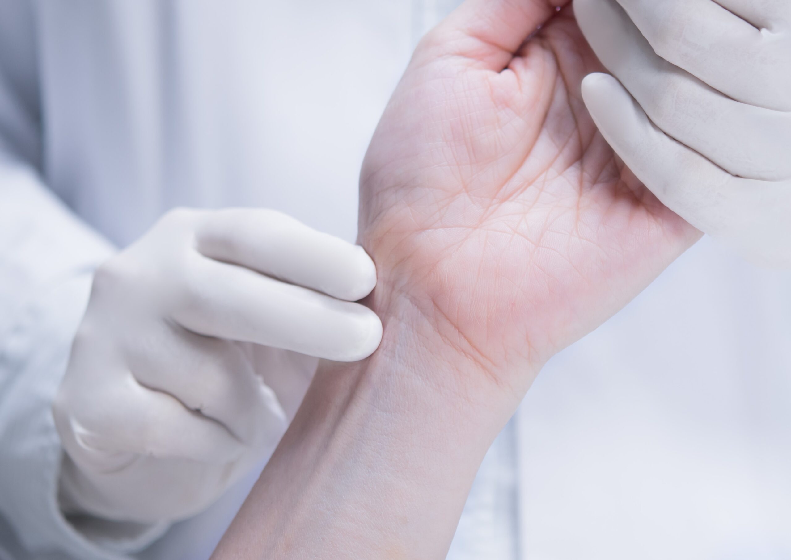 Wrist Arthroscopy Singapore